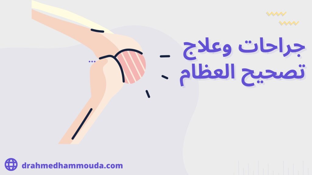 تصحيح العظام