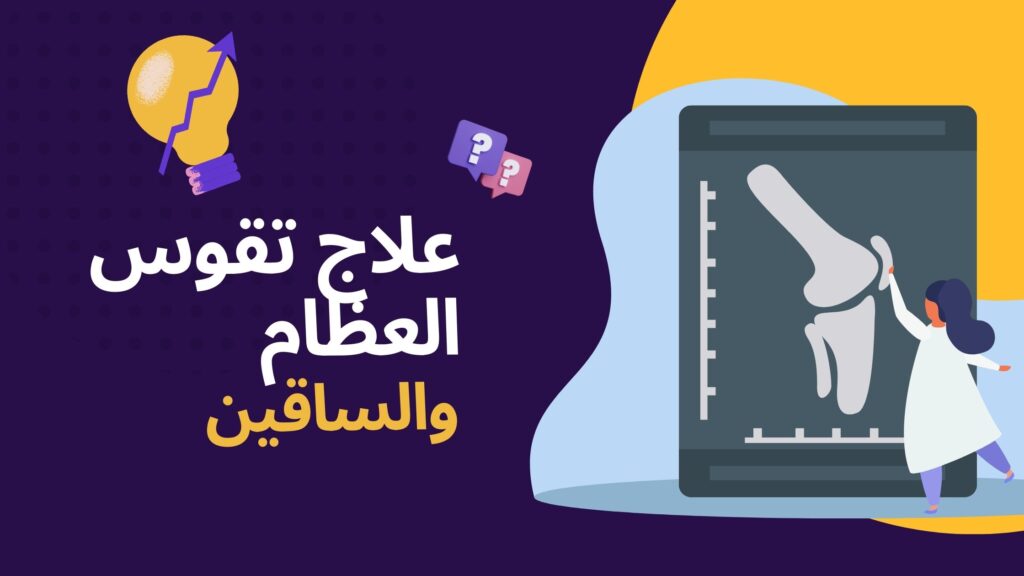 علاج تقوس الساقين والعظام