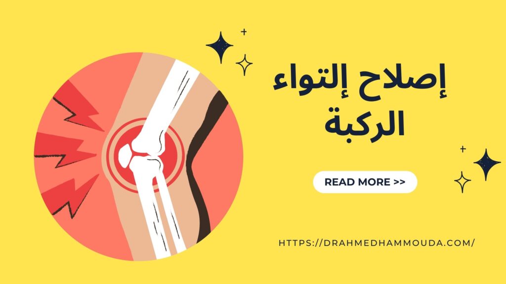 اصلاح التواء الركبة