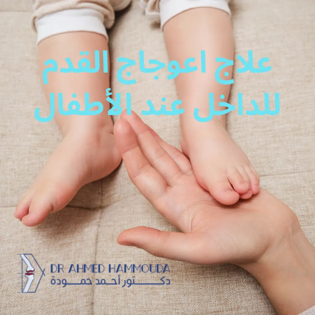 علاج اعوجاج القدم للداخل عند الأطفال