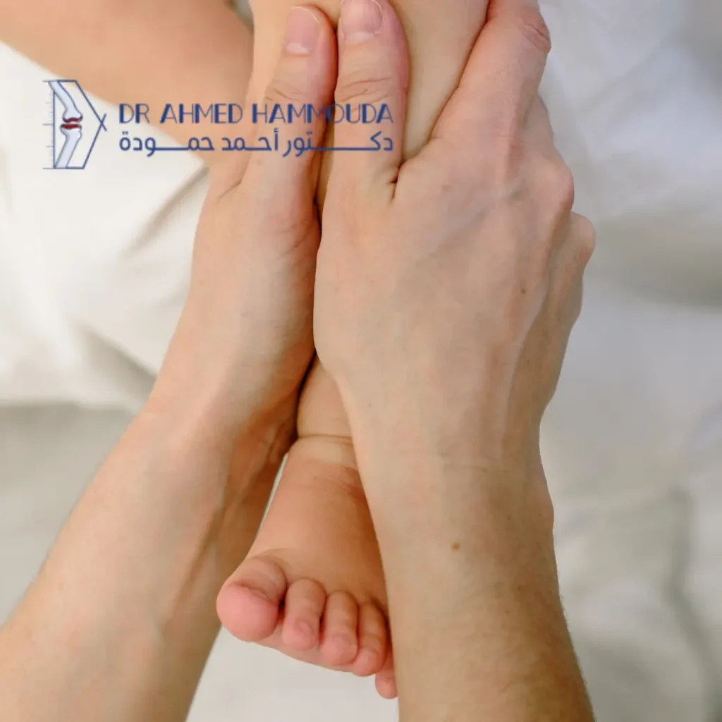 علاج لين العظام عند الأطفال