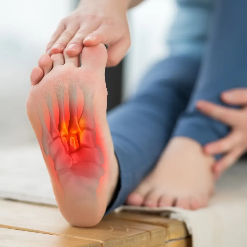 أعراض التهاب اللفافة الأخمصية