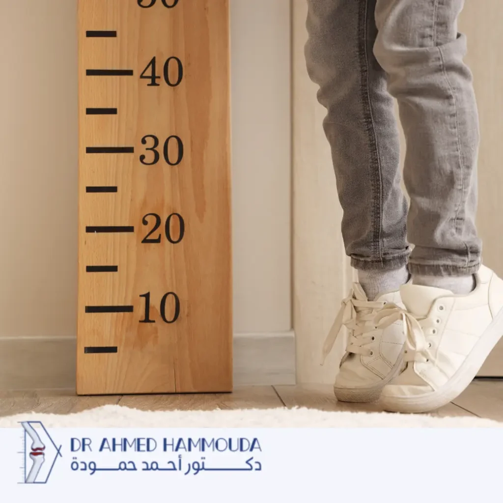 اختلاف الطول بين الساقين