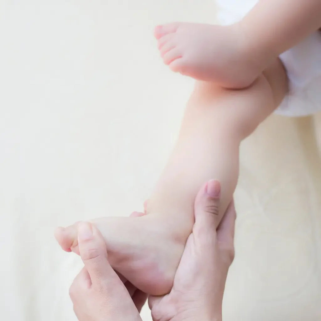 القدم الحنفاء (Clubfoot)عند حديثي الولادة والمعالجة بالجبس