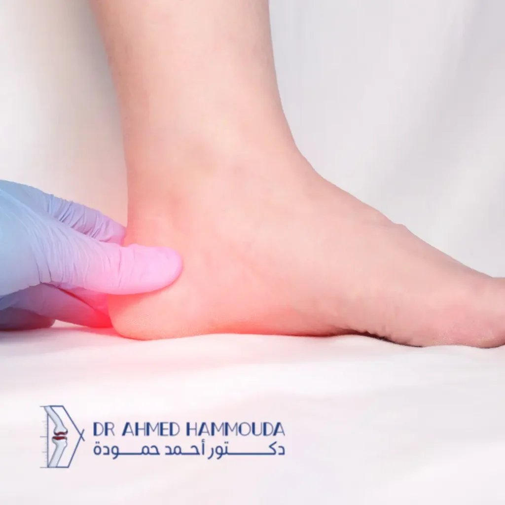 تجربتي مع التهاب اللفافة الأخمصية