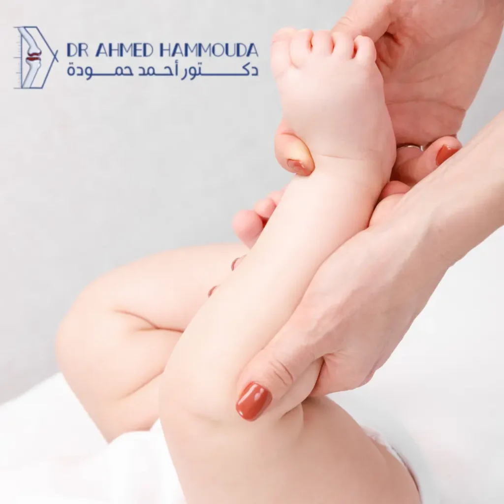 أنواع حنف القدم
