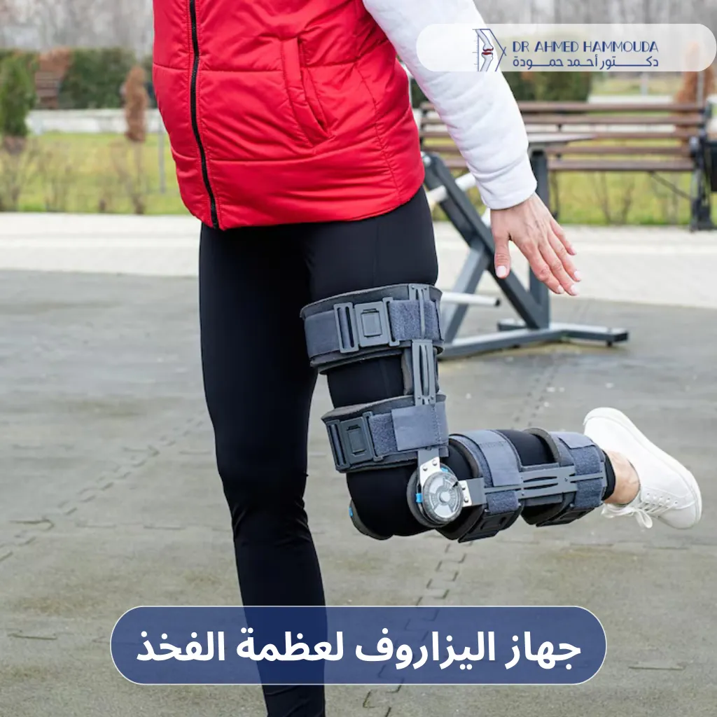 جهاز اليزاروف لعظمة الفخذ - جهاز اليزاروف لعظمة الفخذ