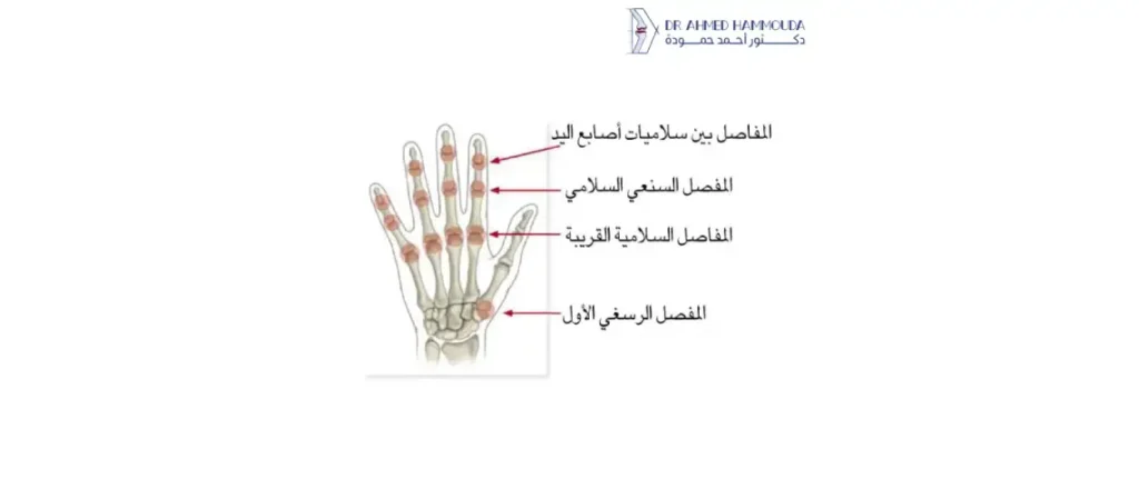 علاج وجع مفصل اليد 01