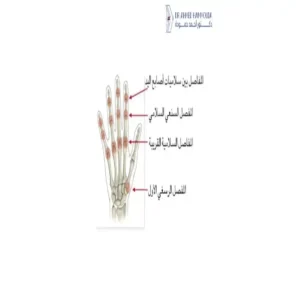 علاج وجع مفصل اليد